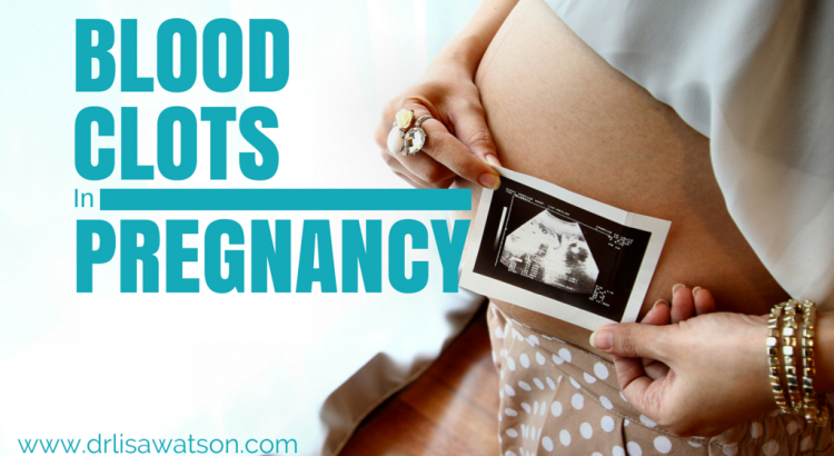 Blood Clots in Pregnancy | Dr. Lisa Watson