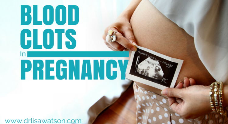 Small Blood Clots During Pregnancy