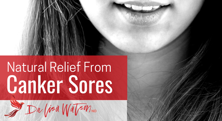 Natural treatments for canker sores