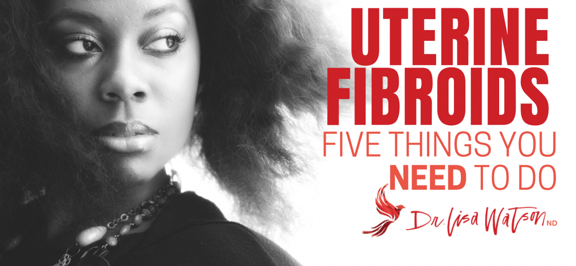 Fibroids_ Five things you need to do