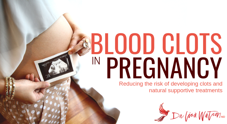 Blood clots in pregnancy