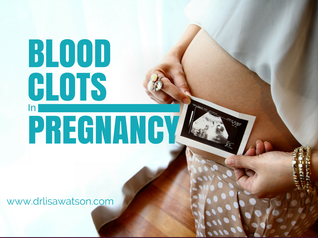 Brown Blood Clots After Pregnancy