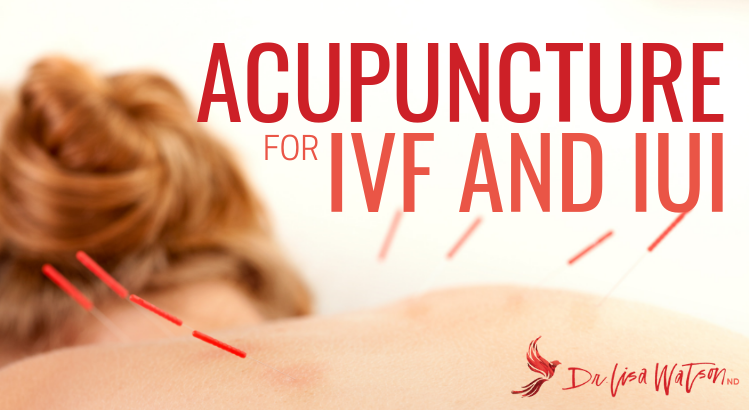 Acupuncture for IVF and IUI Cycles