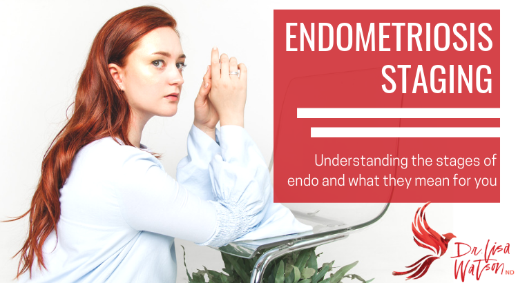 Endometriosis stages