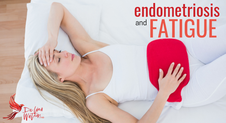 endometriosis and fatigue