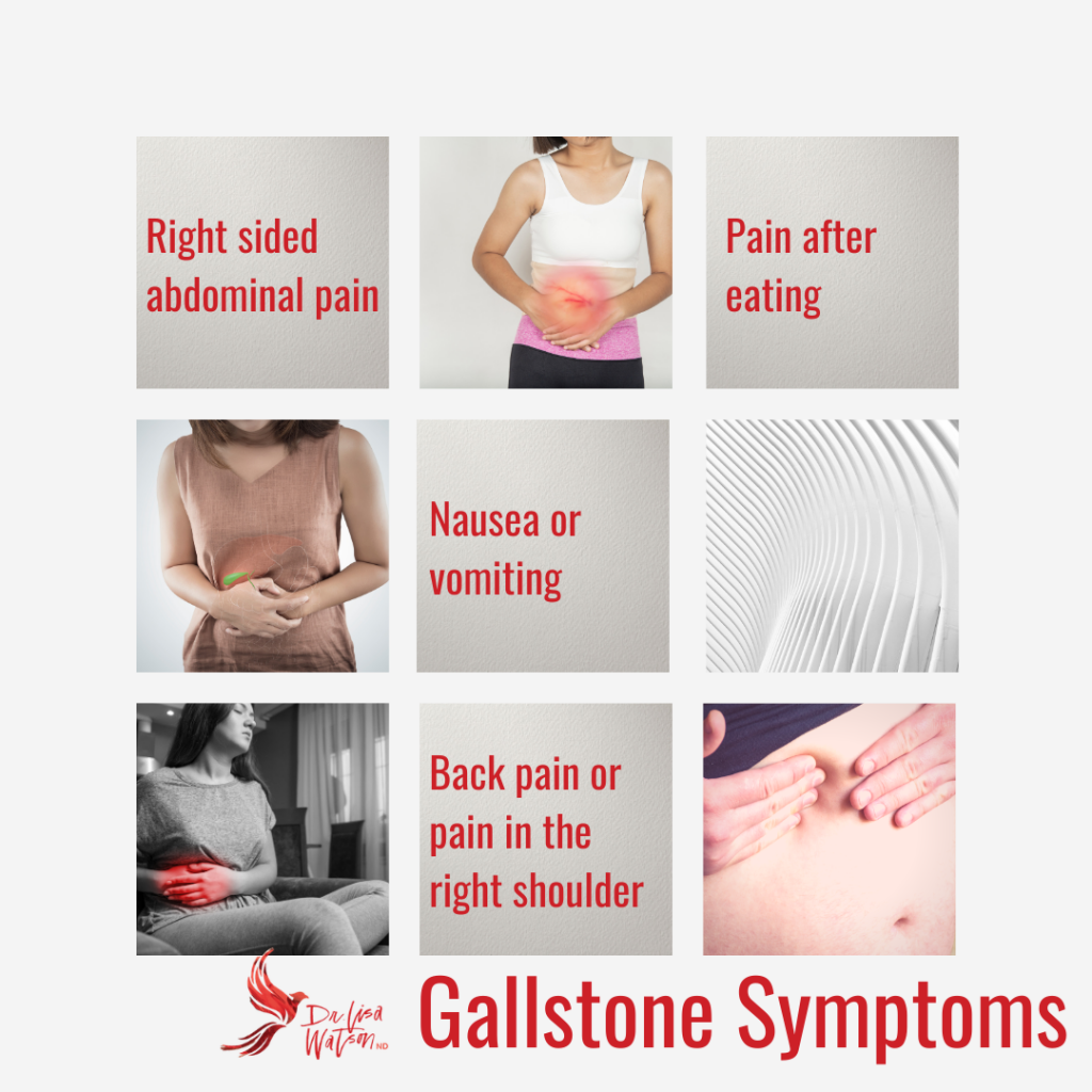 Symptoms of gallstones